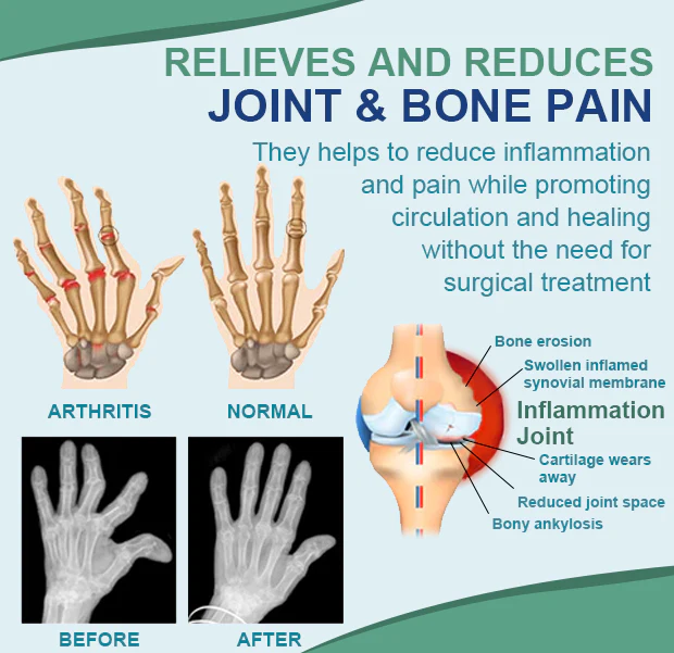 Bigfreeze Joint & Bone Therapy Roll-On Gel