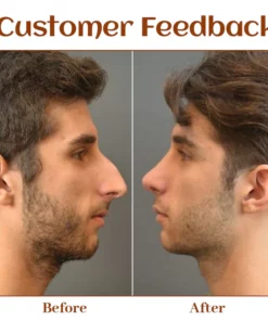 Ceoerty NoseTique Rhinoplasty Serum