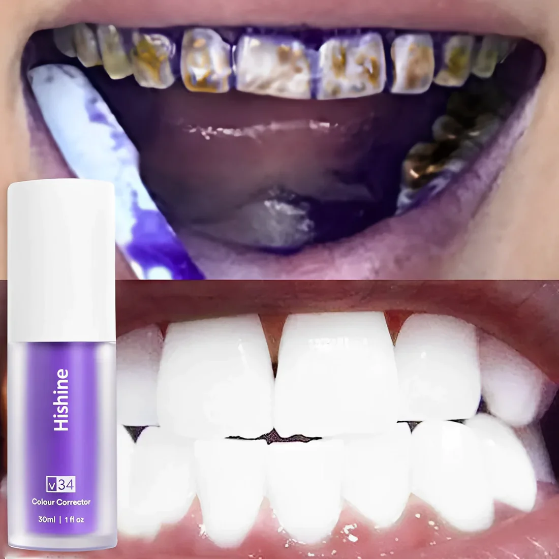 Oveallgo Pure Herbal Teeth Whitening Mousse