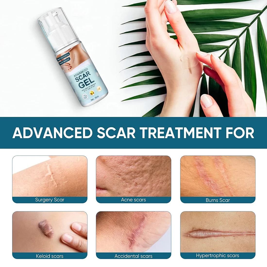 RemoveScar 100% Advanced Scar Remove gel