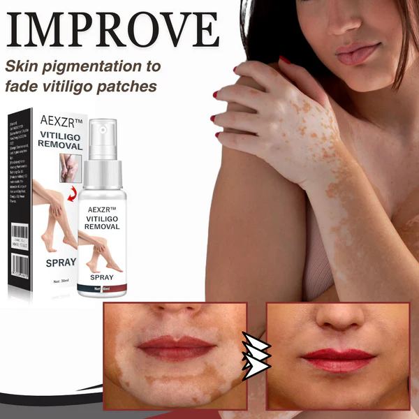 AEXZR Vitiligo Removal Spray