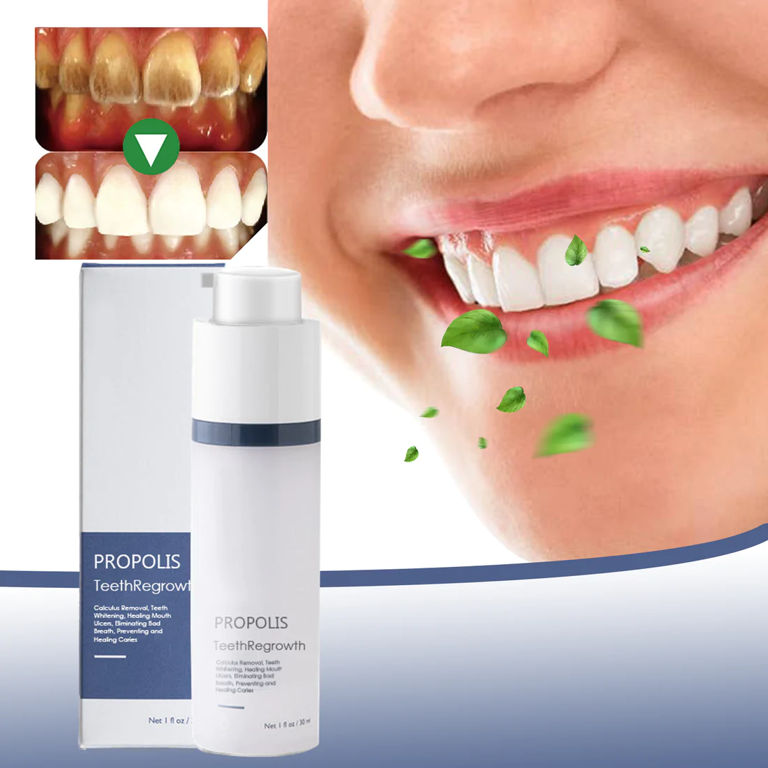 New PROPOLIS TeethRegrowth Dental Gel (Flash Sale Now)