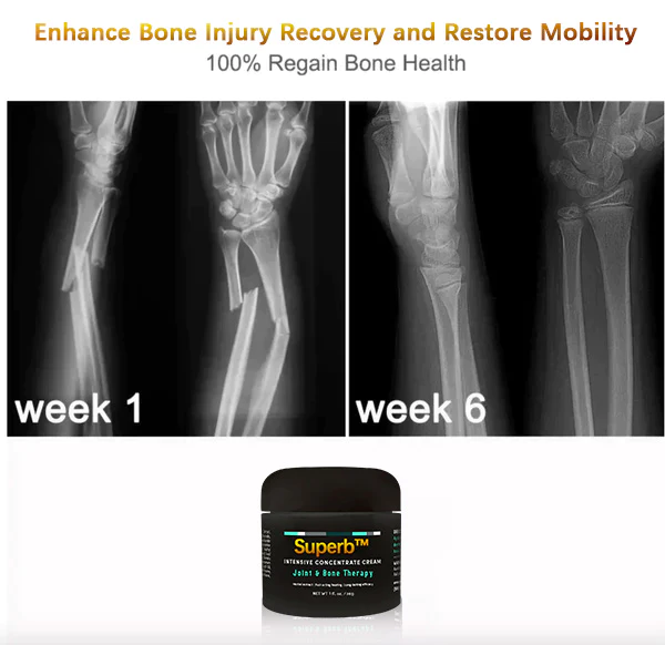 Superb Bone Regeneration Cream