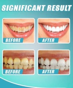 Intensive Stain Removal Whitening Toothpaste