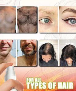 GingerGrowth Anti-Hair Loss Spray