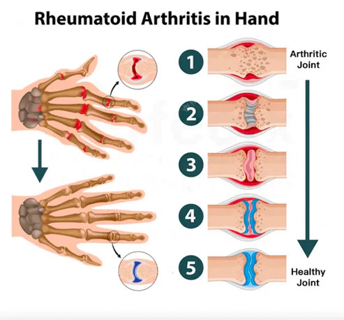 TIMNAMY Joint and Bone Therapy Roll-on liquid  Full Body can be applied-pain disappear(Limited time discount Last 30 minutes)