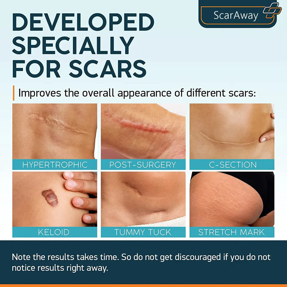 Oveallgo ScarAway Professional Advanced Scar Gel  C-Section, Tummy Tuck, Old Scars, Keloids, Stretch Marks, Burn Scars