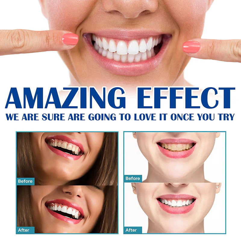 Tohcare Instant Teeth-Whitening Pen