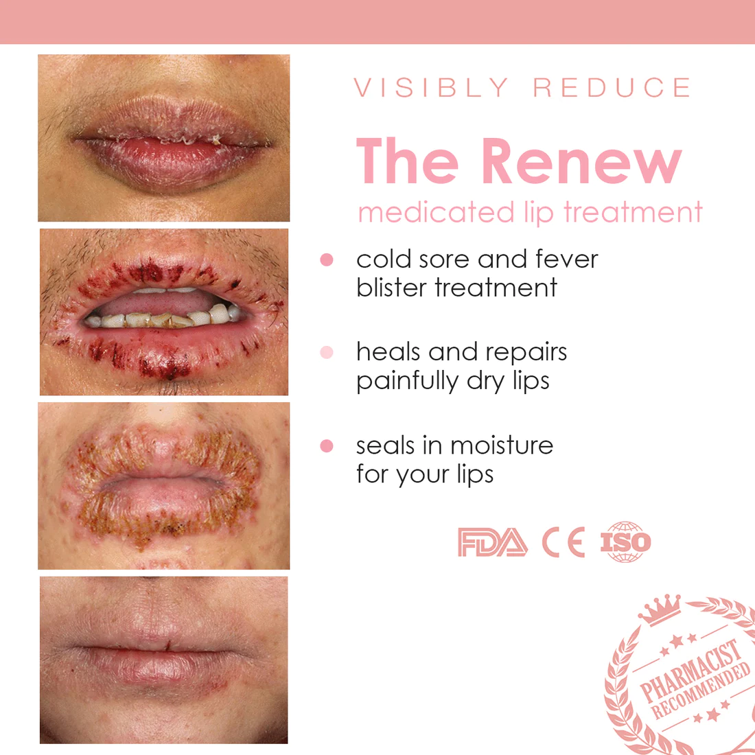 Renew Lip Treatment Balm