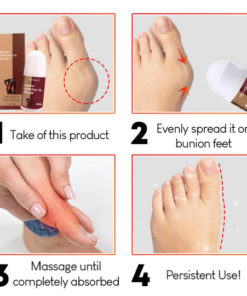 Bunion Essential Oil Roller