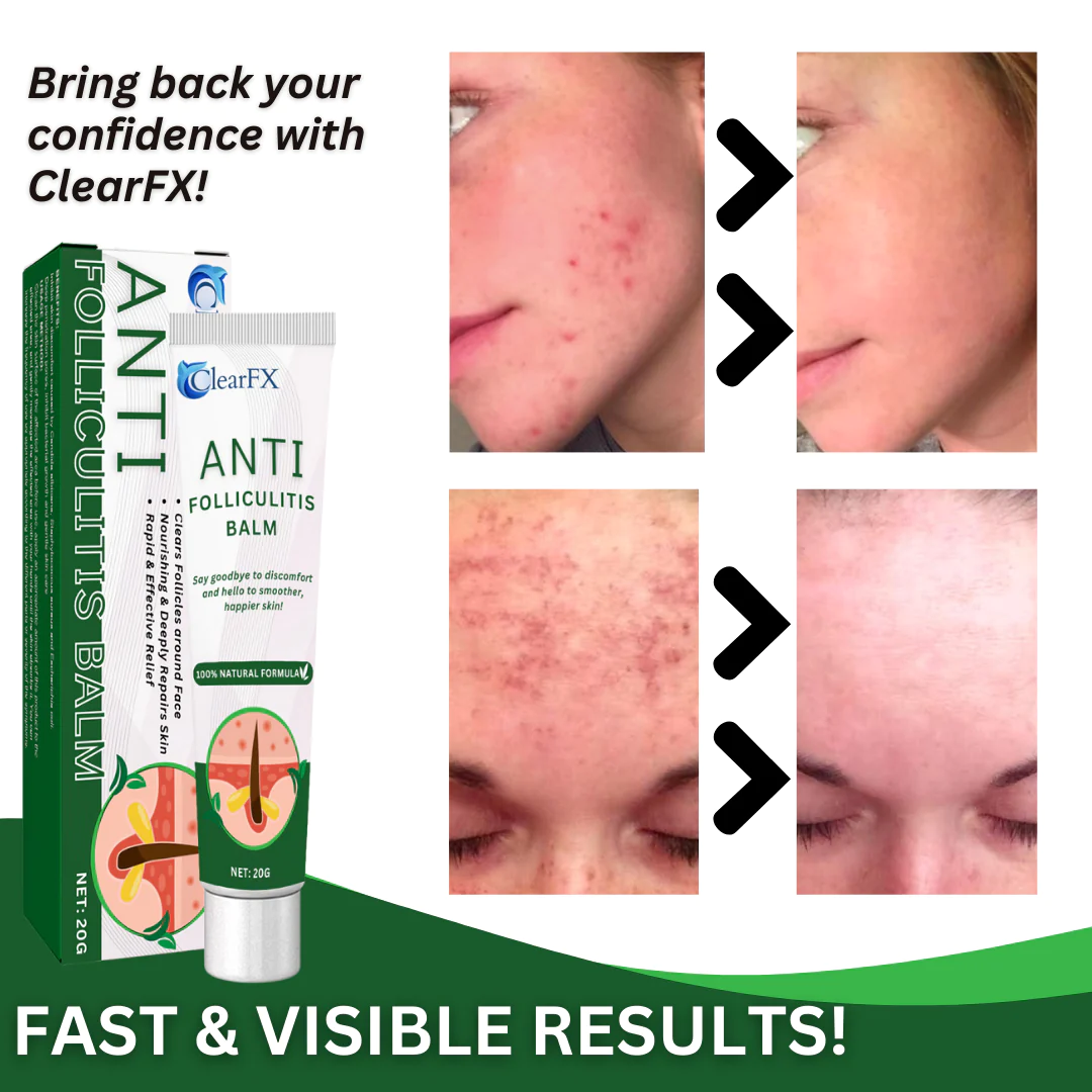 ClearFX Anti-Folliculitis Balm