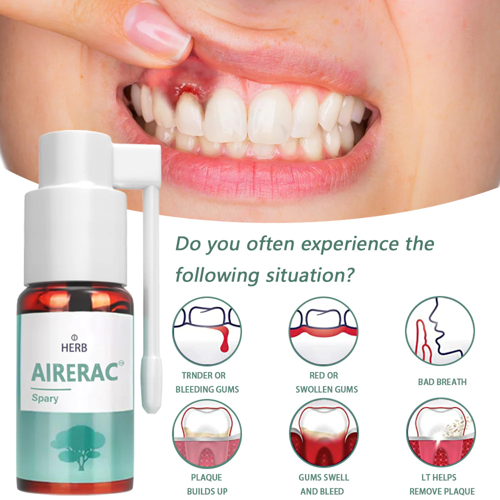 ARERAC Mouth Bleeding/Mouth Ulcers/Lymphatic Cell Hyperplasia at the Base of the Tongue/Oral Disease Treatment Spray