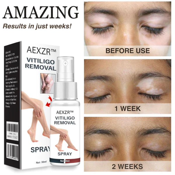 AEXZR Vitiligo Removal Spray