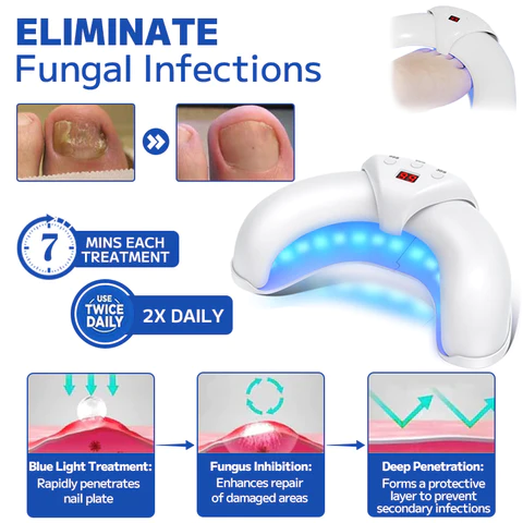 Furzero Fungal Nail Treatment Laser Device