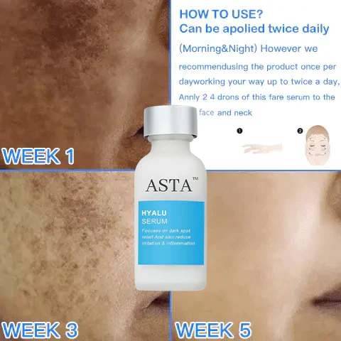 ASTA Dark Spot And Acne Treatment lotion