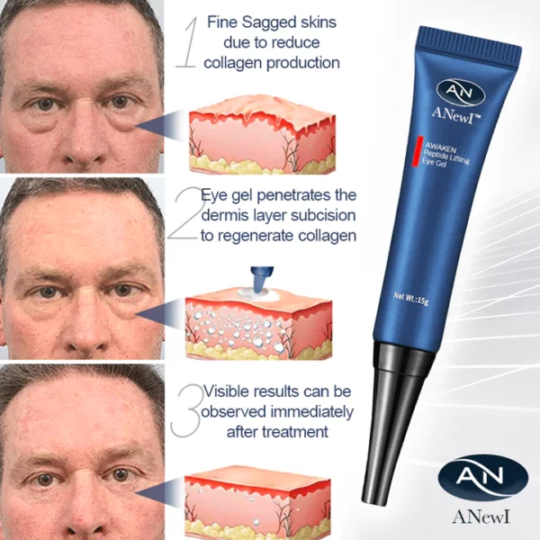 ANewI Pro Eye-Lift Depuffing Gel