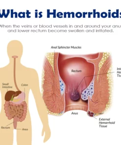 ATTDX InstantHealing NaturalHerbs HemorrhoidCapsules