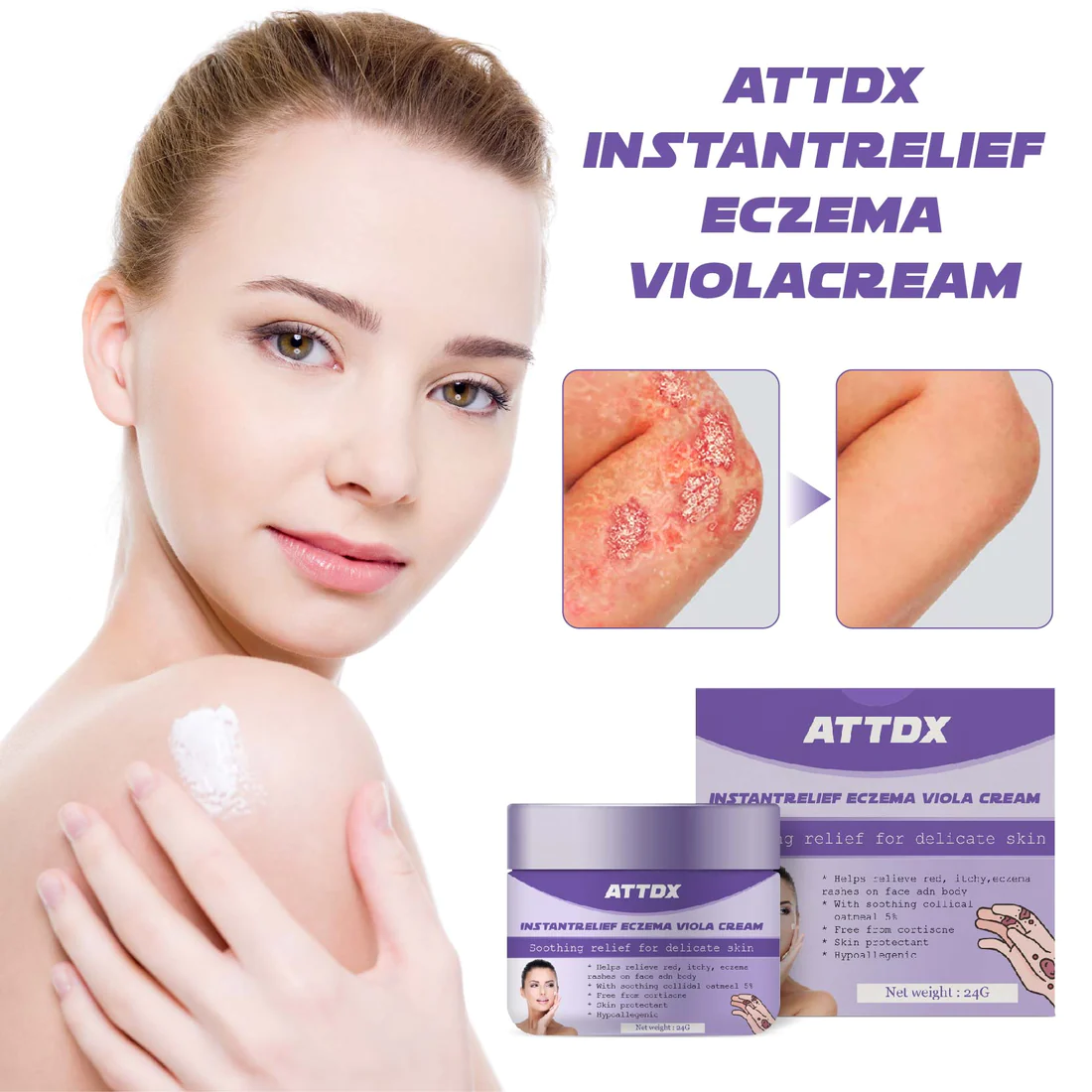 ATTDX InstantRelief Eczema ViolaCream