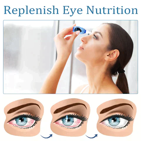 Oveallgo OptiClear Eye Problems Solution Drops