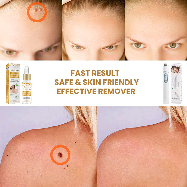 Akemi Dark Spot Solution with Laser Treatment Set