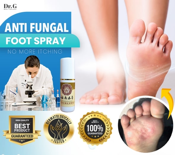 Anti-Fungal Foot Spray