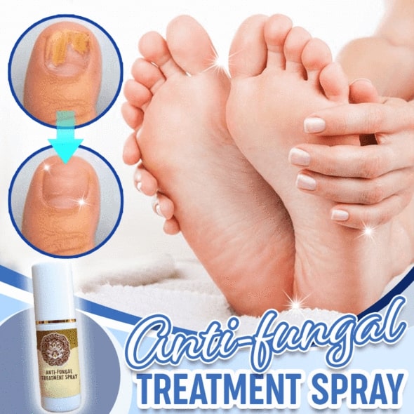 Anti-Fungal Treatment Spray