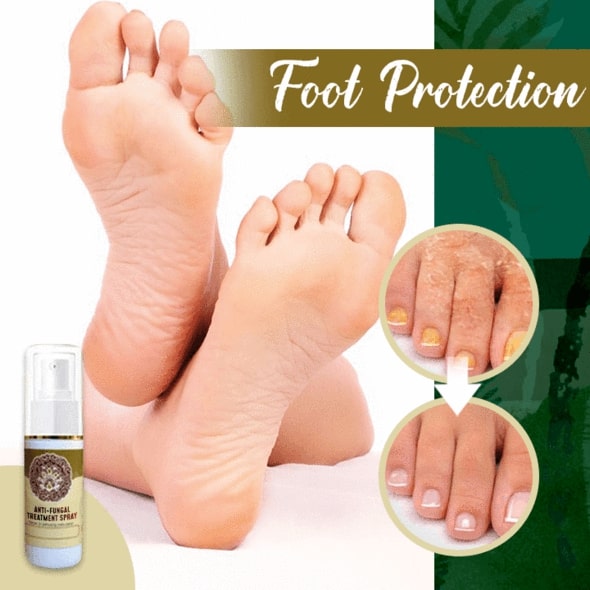 Anti-Fungal Treatment Spray