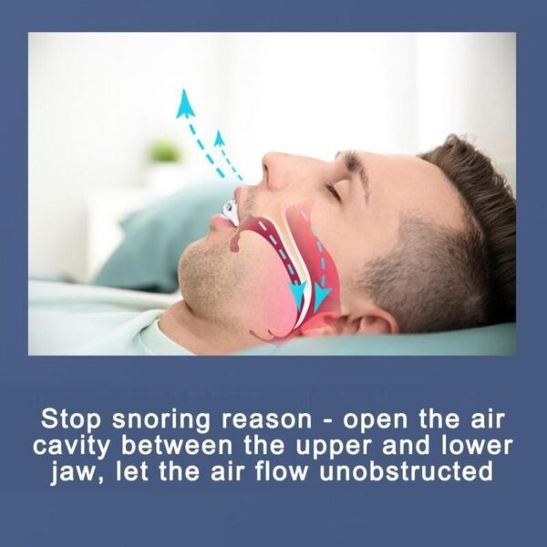 Anti-snoring Silicone Braces