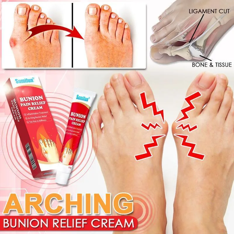 Arching Bunion Relief Cream