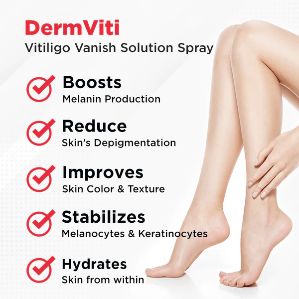 DermViti VitiligoVanish Solution Spray