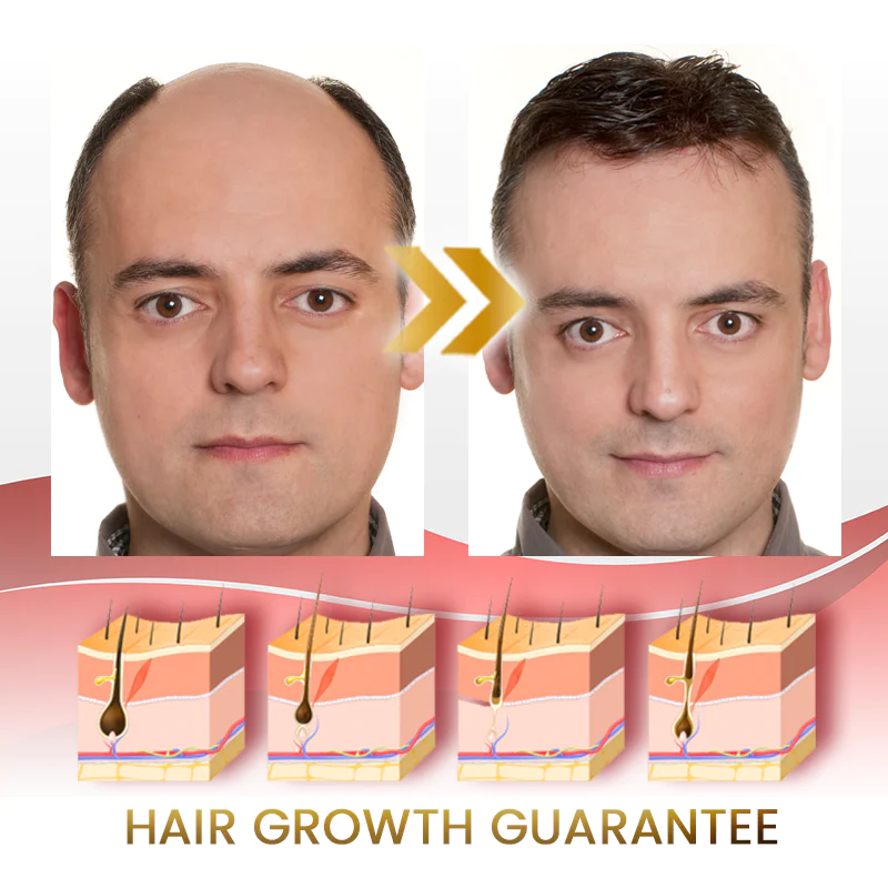 BoostPRO Hair Growing Serum