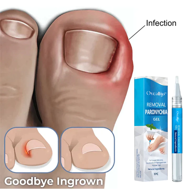 Oveallgo PRO Removal Paronychia Gel