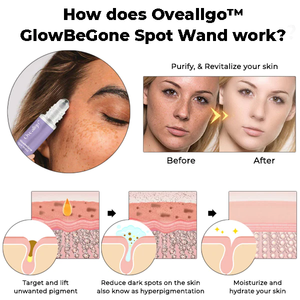 Oveallgo GlowBeGone Spot Wand