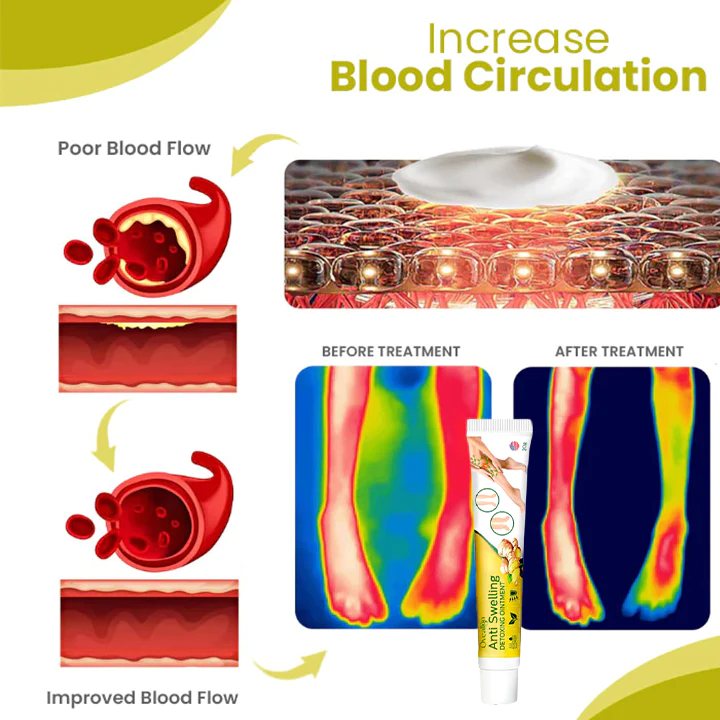 Oveallgo SwellAway Leg Comfort Ginger Ointment