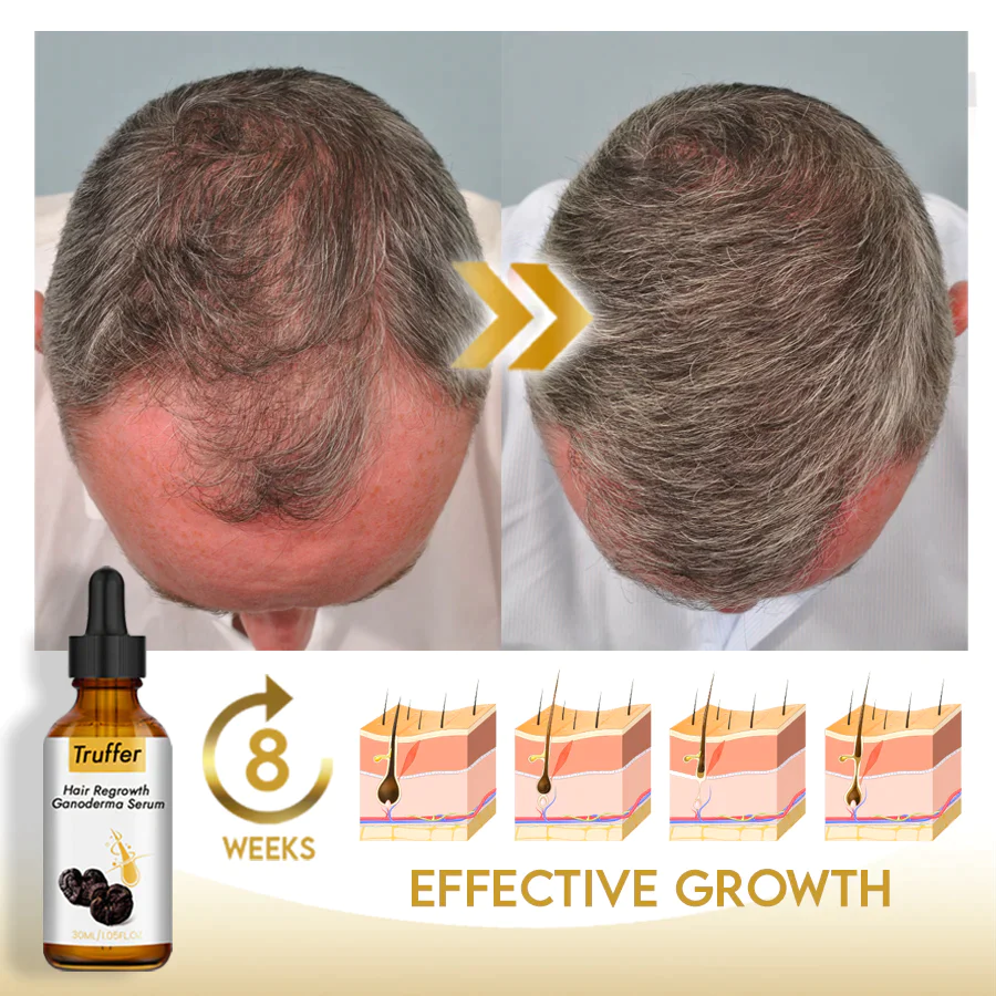 Truffer Hair Regrowth Ganoderma Serum