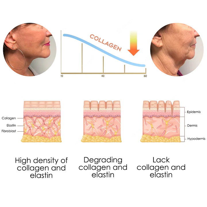 flysmus Japan NeckUp Collagen Whitening Cream