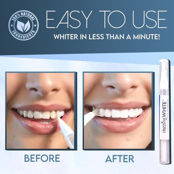 SwipeBright Instant Whitening Oral Pen