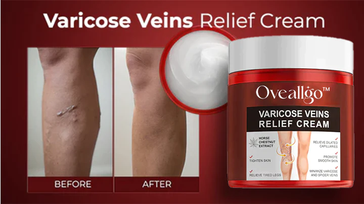 Oveallgo Varicose Veins Relief Cream