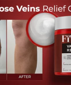 Oveallgo Varicose Veins Relief Cream