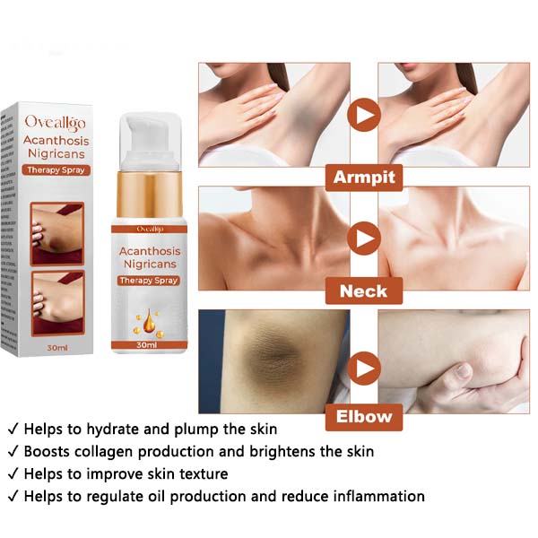 Oveallgo Acanthosis Nigricans Therapy Spray