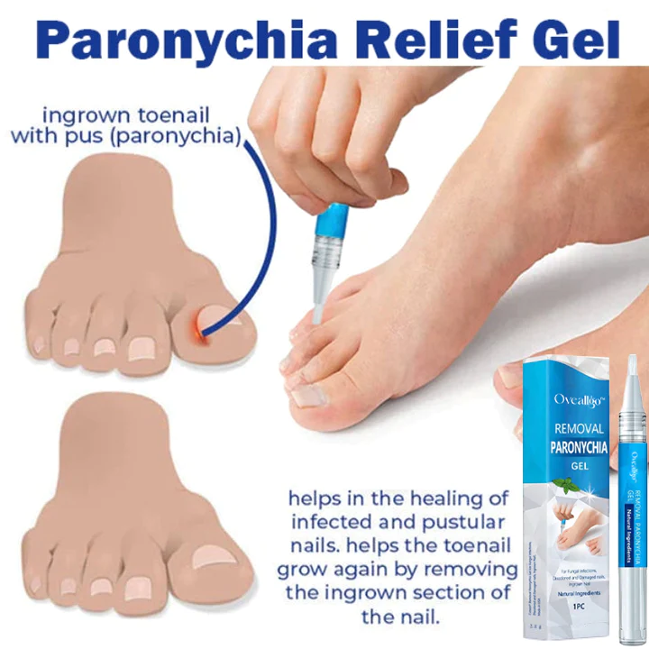 Oveallgo PRO Removal Paronychia Gel