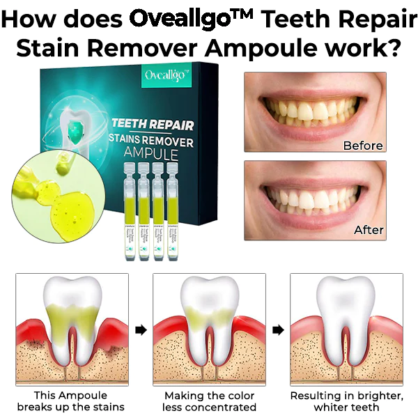 Oveallgo PRO Teeth Repair Stain Remover Ampoule