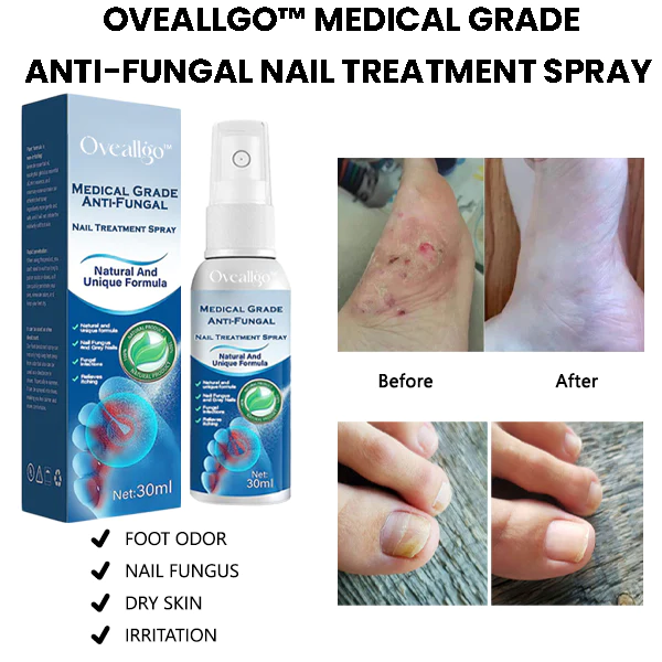 Oveallgo Medical Grade Anti-Fungal Nail Treatment Spray