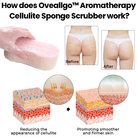 Oveallgo Aromatherapy Cellulite Sponge Scrubber