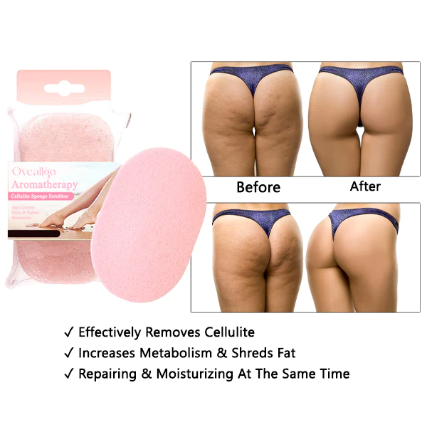 Oveallgo Aromatherapy Cellulite Sponge Scrubber