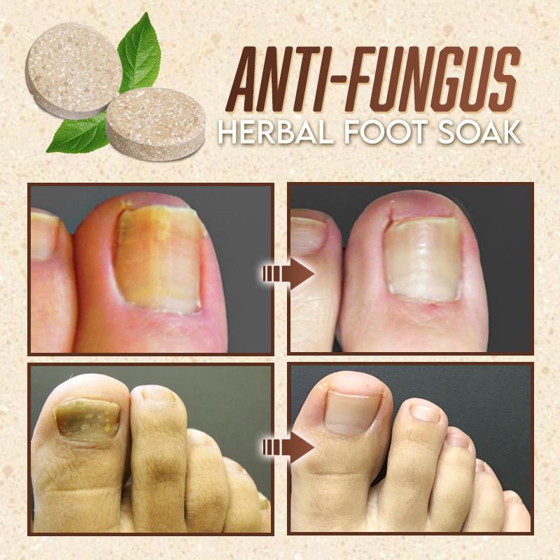 PediCare Anti-Fungal Herbal Foot Soak