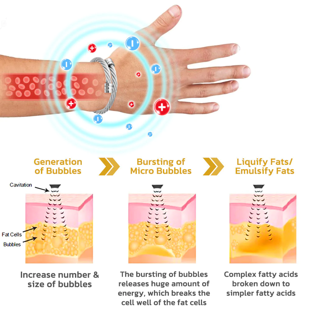 IONTitaan Osimium Wristband