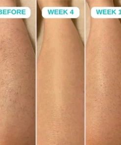 SkinElixir Hair Removal Spray