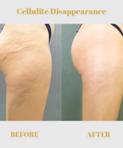 CC Collagen Buttock Enlargement Patch