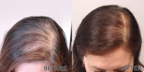 FollicleRX NMN Follicle Reverse Serum